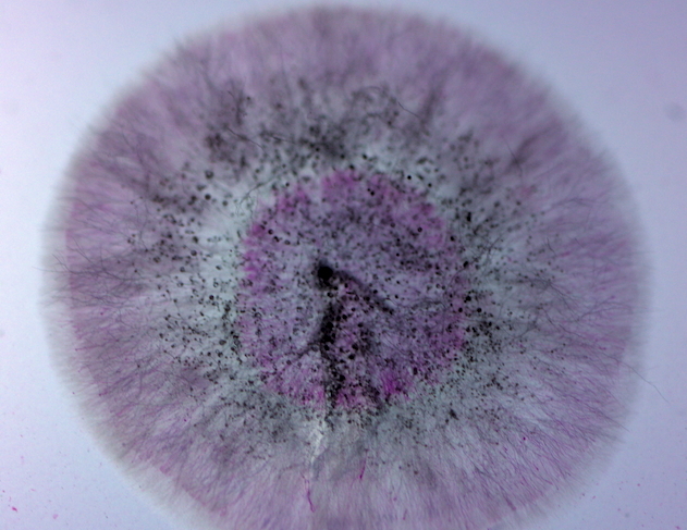 Circular pink-lavender mold colony on agar with a fuzzy outer ring and dense black spore dots in the center